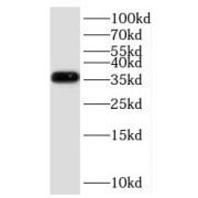 WB analysis of mouse brain tissue, using GNB3 antibody (1/1000 dilution).