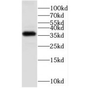 WB analysis of mouse brain tissue, using GNB3 antibody (1/1000 dilution).