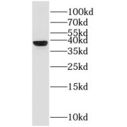 WB analysis of human brain tissue, using GNB4 antibody (1/500 dilution).