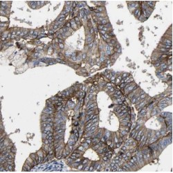 Guanine Nucleotide Binding Protein Subunit Beta 5 (GNB5) Antibody