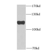 WB analysis of Jurkat cells, using GNE antibody (1/1000 dilution).