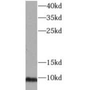 WB analysis of mouse brain tissue, using GNG4 antibody (1/400 dilution).