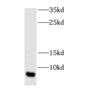 WB analysis of mouse eye tissue, using GNGT1 antibody (1/100 dilution).