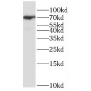 WB analysis of MCF7 cells, using GNL1 antibody (1/300 dilution).