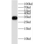 WB analysis of mouse liver tissue, using GNMT antibody (1/1000 dilution).