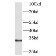 WB analysis of K-562 cells, using GNPDA1 antibody (1/400 dilution).