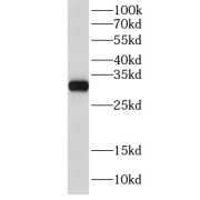 WB analysis of rat kidney tissue, using GNPDA2 antibody (1/600 dilution).