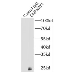 Glucosamine-Phosphate N-Acetyltransferase 1 (GNPNAT1) Antibody