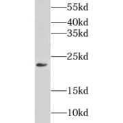 WB analysis of mouse large intestine tissue, using GNPNAT1 antibody (1/300 dilution).