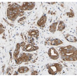 N-Acetylglucosamine-6-Sulfatase (GNS) Antibody