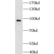 WB analysis of PC-3 cells, using GNS antibody (1/600 dilution).