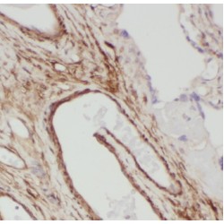 Golgi Phosphoprotein 3 (GOLPH3) Antibody