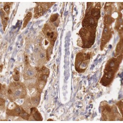 Aspartate Aminotransferase, Cytoplasmic (GOT1) Antibody