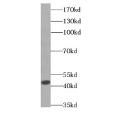 WB analysis of human brain tissue, using GOT1 antibody (1/1000 dilution).