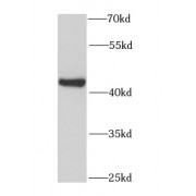 WB analysis of mouse brain tissue, using GOT2 antibody (1/1200 dilution).