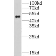 WB analysis of HEK-293 cells, using GPATCH4 antibody (1/1000 dilution).