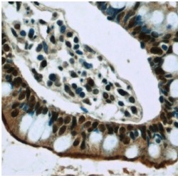 Vasculin (GPBP1) Antibody