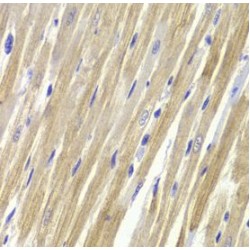 Glycerol-3-Phosphate Dehydrogenase 1 (GPD1) Antibody