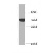 WB analysis of mouse kidney tissue, using GPD1 antibody (1/1000 dilution).