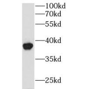 WB analysis of mouse stomach tissue, using GPD1L antibody (1/1000 dilution).