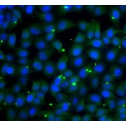 Glucose 6 Phosphate Isomerase (GPI) Antibody