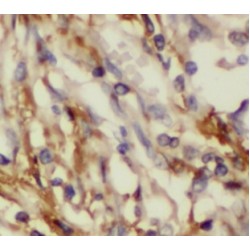 Glucose 6 Phosphate Isomerase (GPI) Antibody