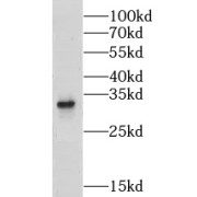 WB analysis of A549 cells, using GPR35 antibody (1/1000 dilution).