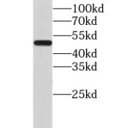 WB analysis of human brain tissue, using GPR83 antibody (1/500 dilution).