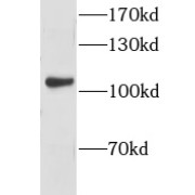 WB analysis of mouse brain tissue, using GPRIN1 antibody (1/1000 dilution).