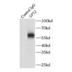 Alanine Aminotransferase 2 (GPT2) Antibody