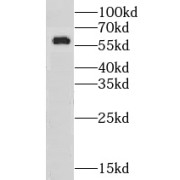 WB analysis of mouse kidney tissue, using GPT2 antibody (1/600 dilution).