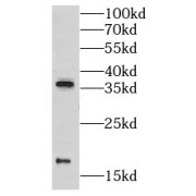 WB analysis of Recombinant protein, using GR repeat antibody (1/1000 dilution).