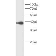 abx233635