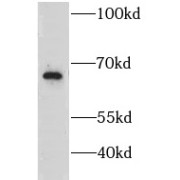 WB analysis of mouse liver tissue, using GRB10 antibody (1/500 dilution).