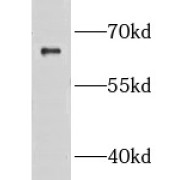 WB analysis of DU 145 cells, using GRB14 antibody (1/600 dilution).