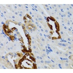 Growth Factor Receptor Bound Protein 2 (GRB2) Antibody