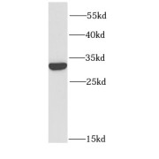 WB analysis of SW480 cells, using GRB2 antibody (1/1000 dilution).