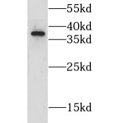 WB analysis of mouse liver tissue, using GRHPR antibody (1/600 dilution).