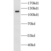 WB analysis of human brain tissue, using GRIK2 antibody (1/500 dilution).