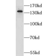 WB analysis of mouse brain tissue, using GRIP1 antibody (1/1000 dilution).