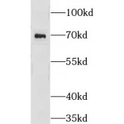 WB analysis of human skeletal muscle tissue, using GRK5 antibody (1/500).