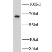 WB analysis of HEK-293 cells, using GRK6 antibody (1/1000 dilution).