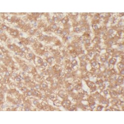 Somatotropin / Growth Hormone (GH1) Antibody