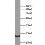 WB analysis of human placenta tissue, using GH1 antibody (1/1000 dilution).