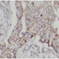 Endoplasmin (GRP94) Antibody