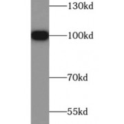 WB analysis of A549 cells, using HSP90B1 antibody (1/1000 dilution).