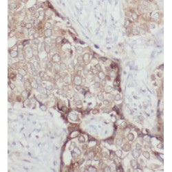 Endoplasmin (GRP94) Antibody