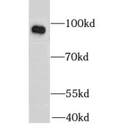 WB analysis of A549 cells, using HSP90B1 antibody (1/1000 dilution).