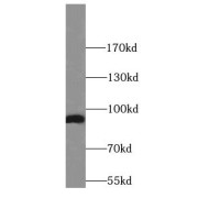 WB analysis of human heart tissue, using GRP94 antibody (1/1000 dilution).