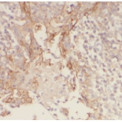 Germ Cell-Specific Gene 1-Like Protein (GSG1L) Antibody